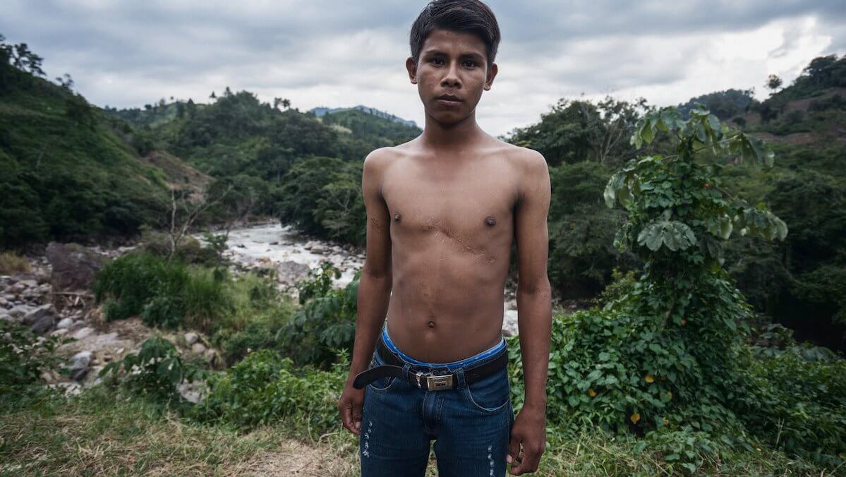Alan García, de 17 años, sobrevivió a una bala que lo alcanzó en el pecho. Estaba protestando en la tierra de su comunidad cuando el ejército abrió fuego. Su padre murió asesinado a tiros en el mismo ataque.