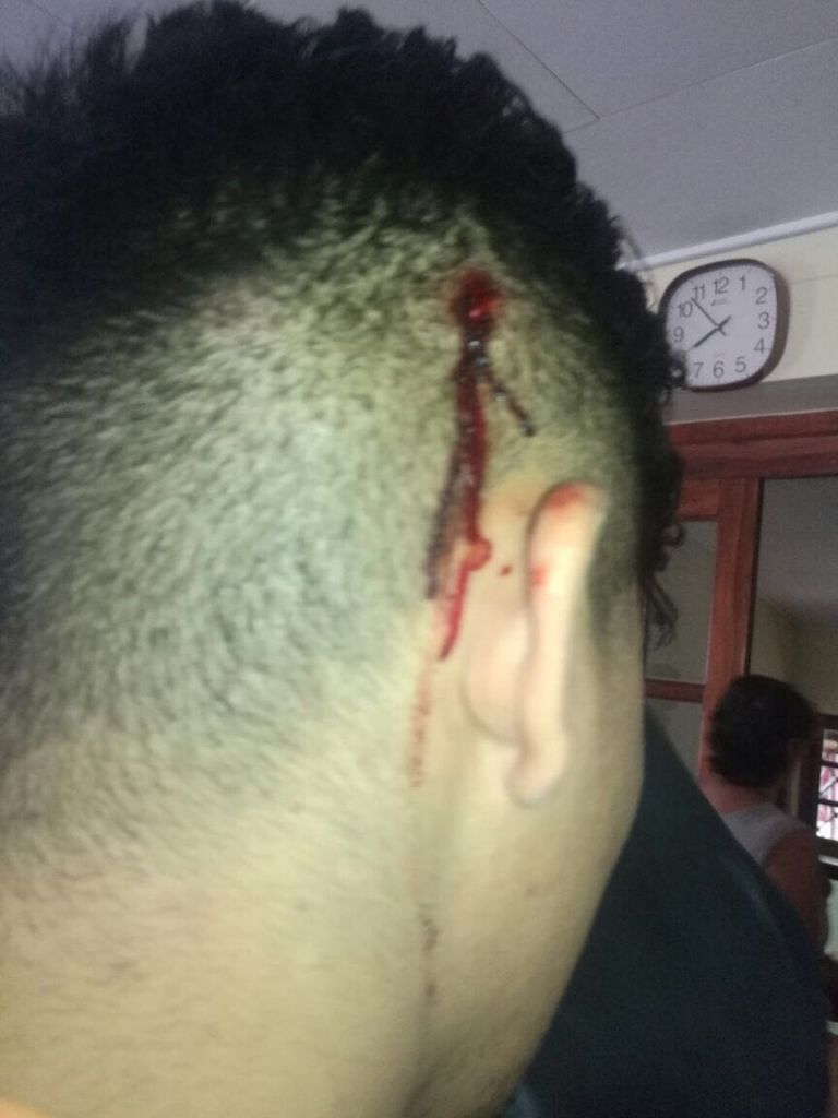 militares disparan contra vehículo de periodista de Canal 11 Nilsa Sosa y golpean a manifestantes