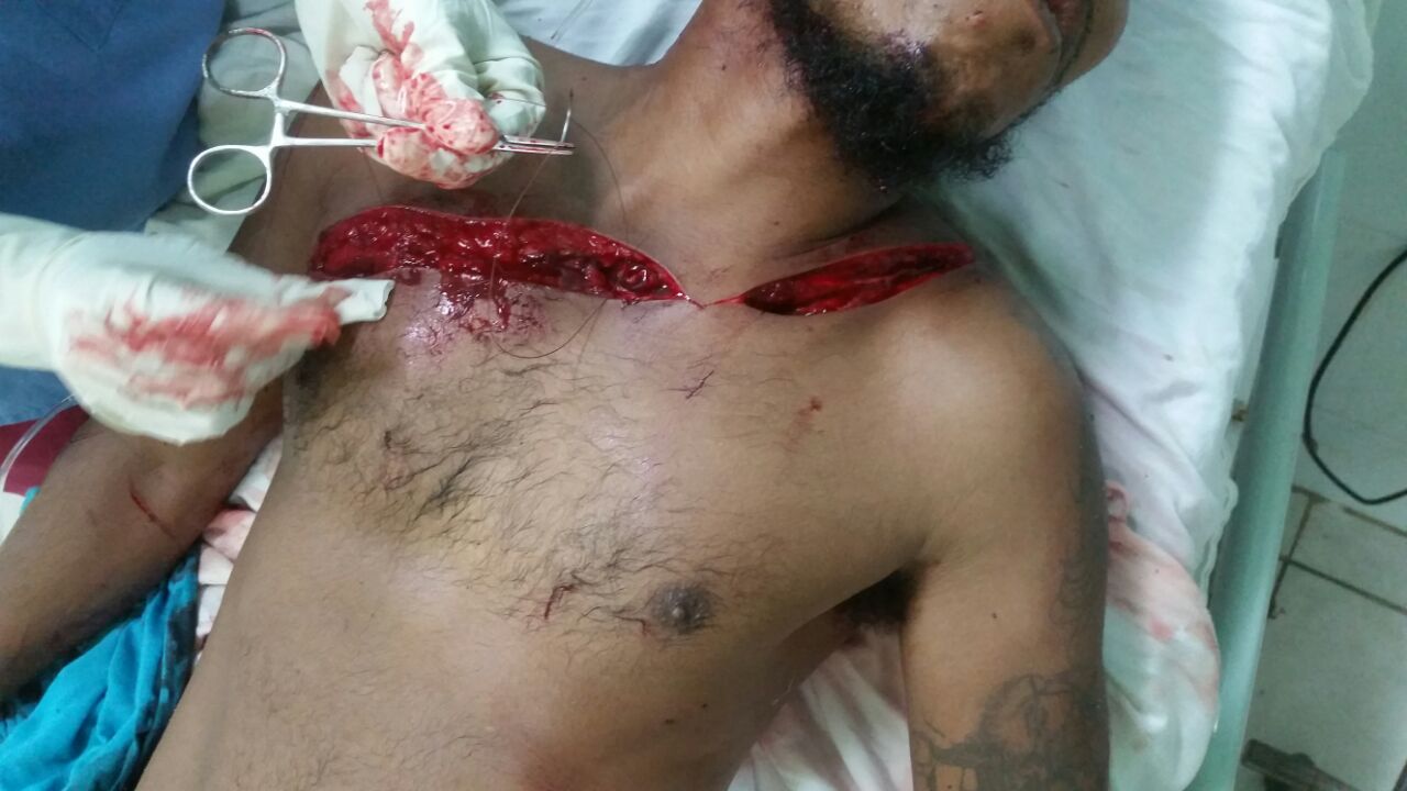 Olanchito Yoro Macheteado Olanchito Yoro Macheteado