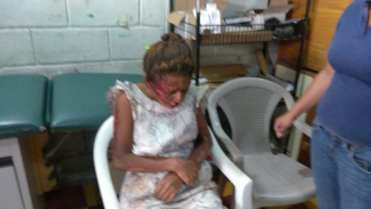 víctimas de explosión en Copán