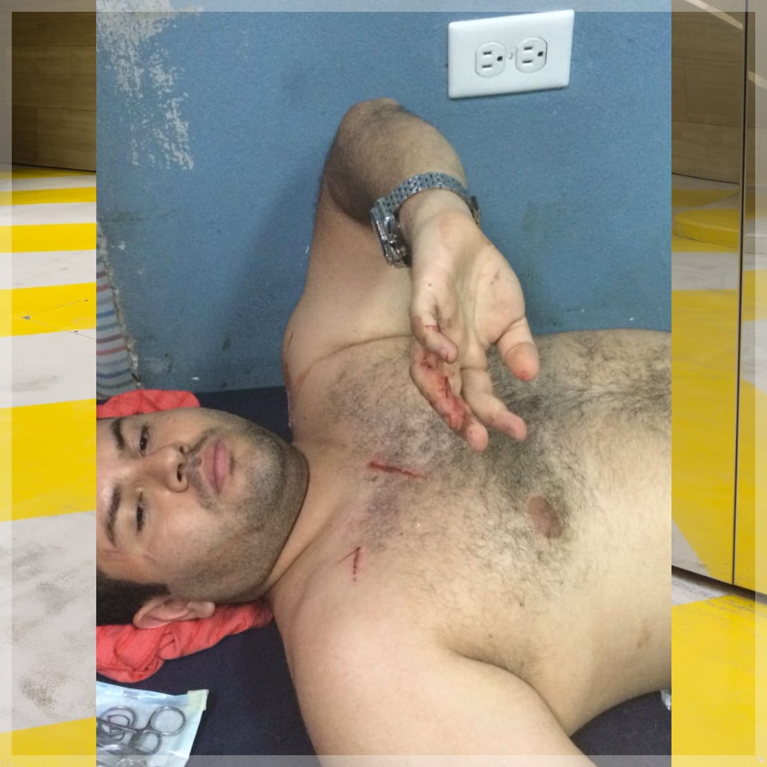 catedrático herido por estudiante catedrático herido por estudiante