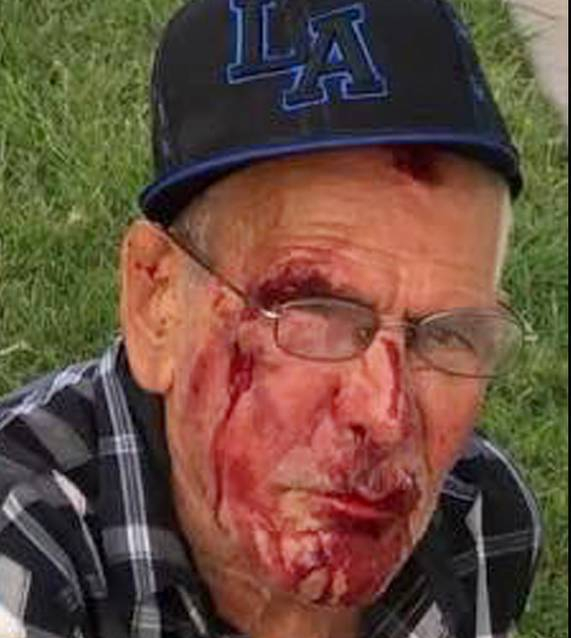 mujer que golpeó a un anciano Rodolfo Rodríguez mujer que golpeó a un anciano Rodolfo Rodríguez