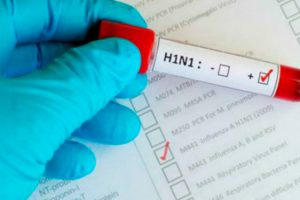 Influenza-H1N1