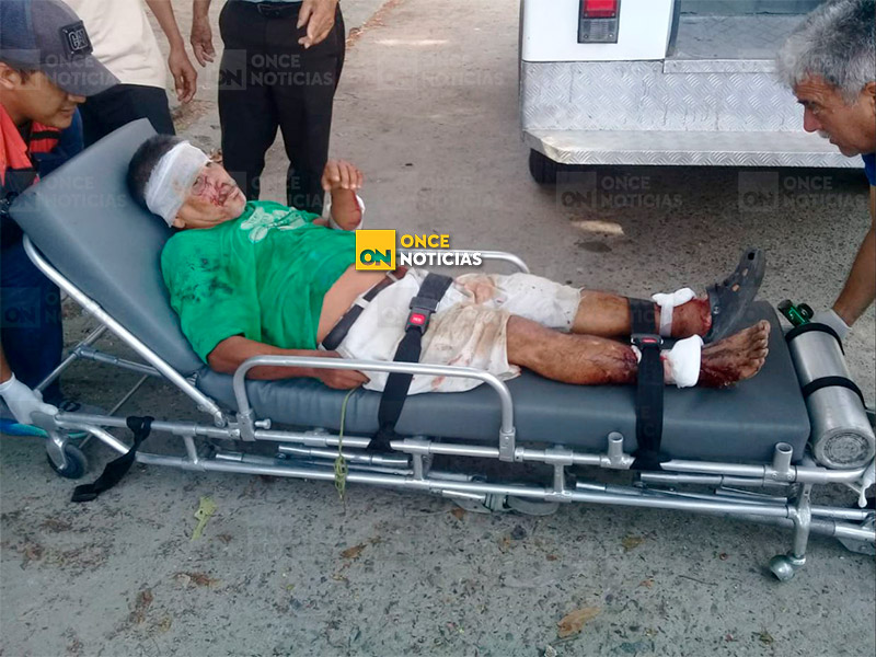Pitbull atacan a hombre Ángel Orellana Pitbull atacan a hombre Ángel Orellana