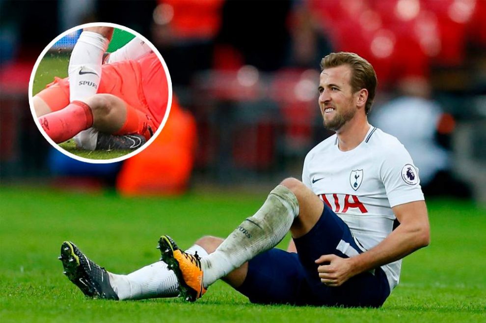 Tottenham pierde a Harry Kane