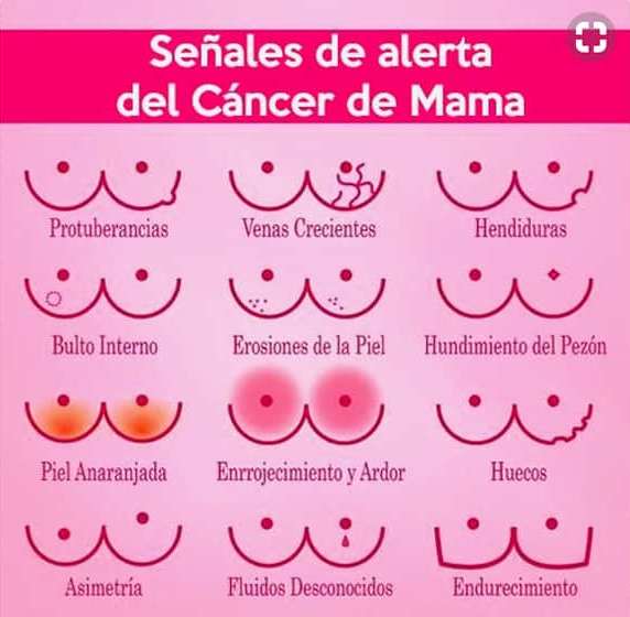 Síntomas frecuentes de cáncer de mama.