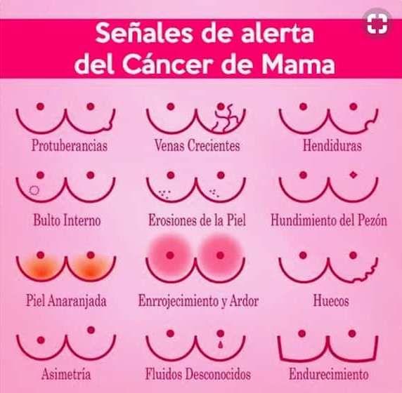 Síntomas frecuentes de cáncer de mama.