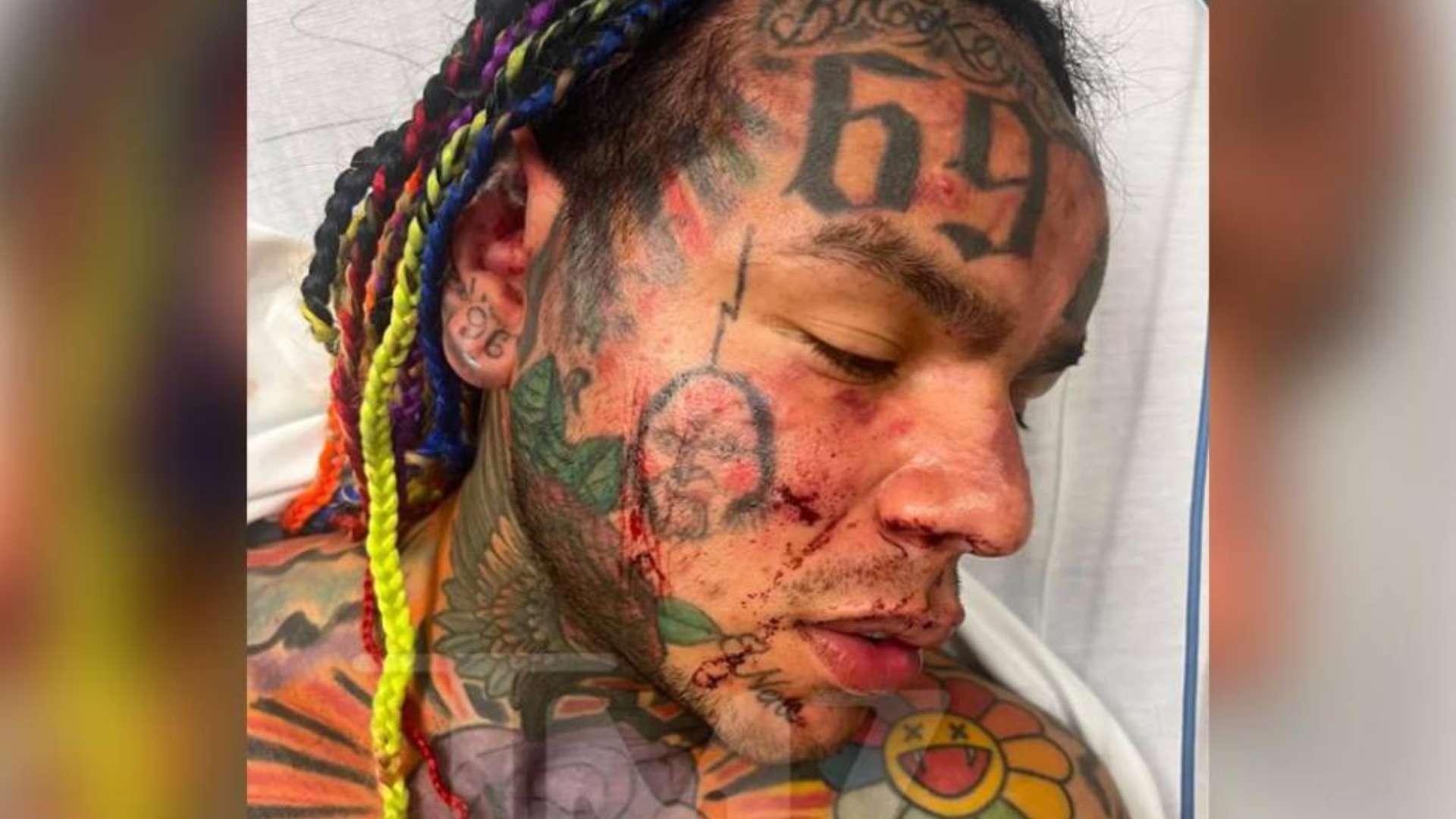 6ix9ine