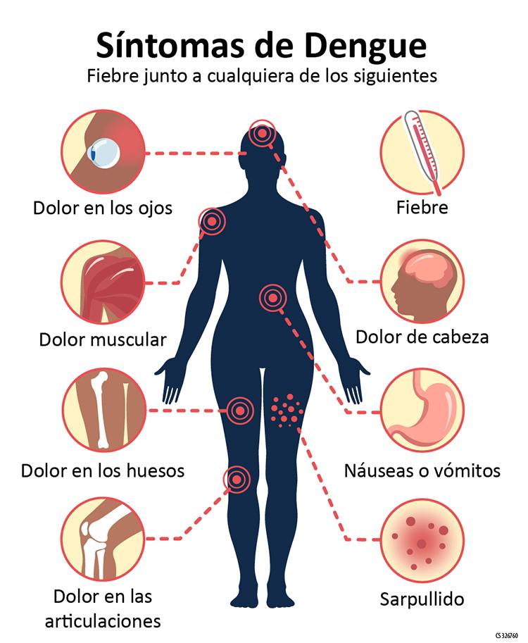 dengue síntomas